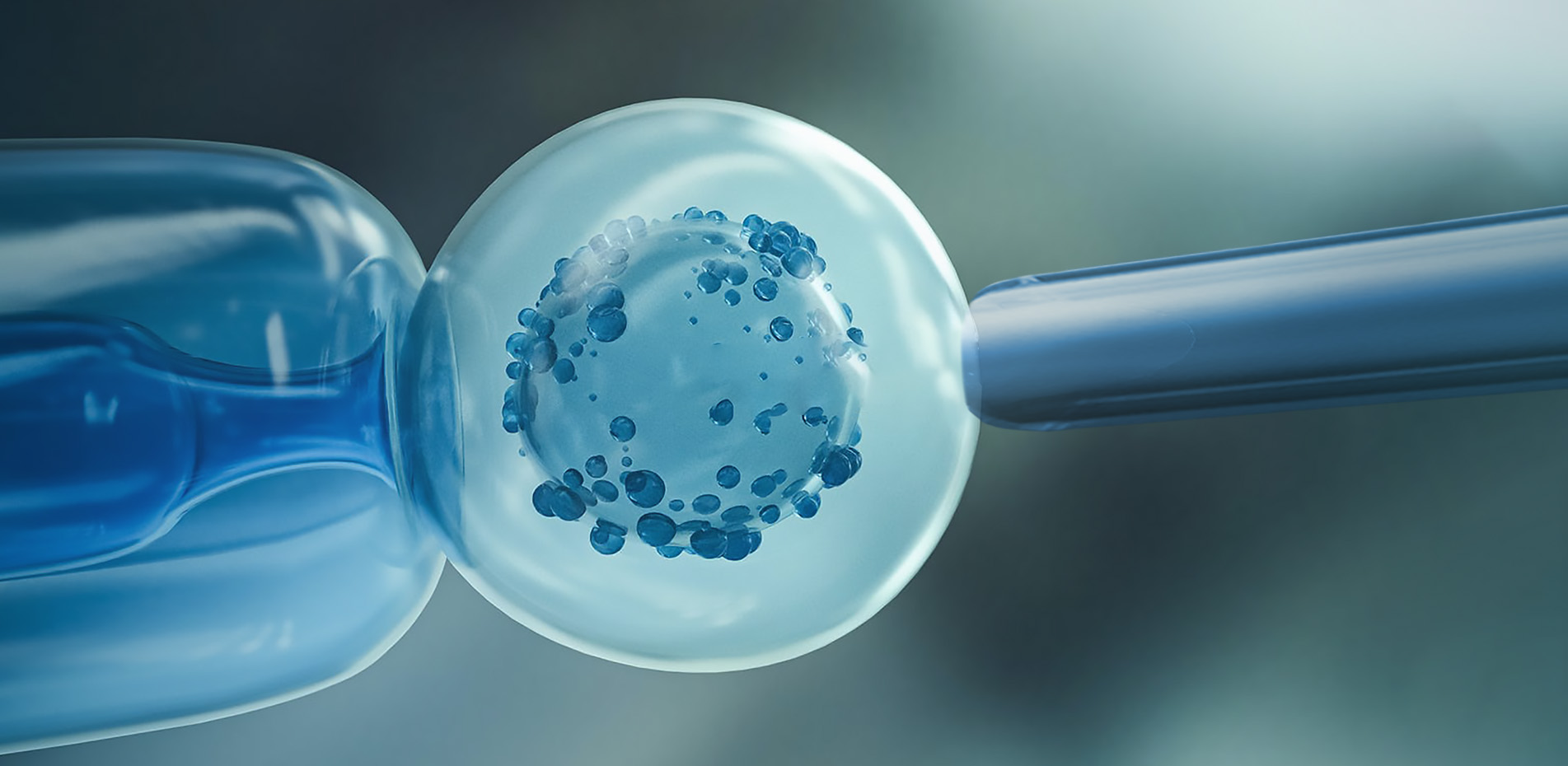 PGT DNA Screening and Gender Selection in Lahore, Pakistan